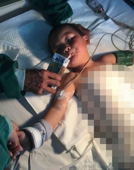 ҽ��˵��&ldquo;������Ȼ���������40%�������˵����ֽš�ͷ���ȱ�¶��λ��û�����ˡ��������ˣ������Ժ���������Ӱ��ǳ�С��&rdquo;���ǳ������Ƶ�������������Ҫ30�򣬽�������Ҫ��2��3�ε�ֲƤ������30��Ԫҽ�ƷѶ��ڼ�ͽ�ıڵļͺ갲��˵�����������֡��⼸�죬�����������ѣ�Ҳֻ�ﵽ1��ԪǮ��