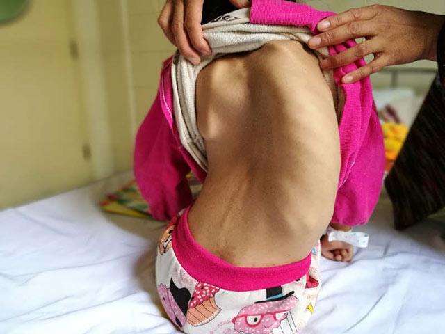 ��󱱾�������ҽԺ����ϣ����7��������ҽ�����������迴����ϣ�������ǽ���������Ϣ�����û���Ļ��ĸ�Ů���׺䶥�����ò��鸴�ӣ�����Ƚ�С����ÿ�궼Ҫ������������Ҫ�������������������ƷѸߴ�����ʮ�򡣶���ũ���ͥ�����������������������㡣