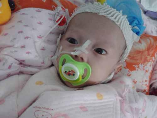 2015��7��1�գ�˼�������ˣ�����ĸ�����˼����ϲ�úͿ��֣������������˵Ķ���,�����Ŀ�ʼҲ���ǲ�ʹ�Ŀ�ʼ.˼�������������̡���ˮ���£��������˸��ͣ���������Ƽ�����Ϊ��������Ѫ��֢������Ѫ֢���޴��ض���������ȱѪȱ�����������ߵ�����Ѫ֢�������Ϊ�����Ծ޽᳦��Դ����