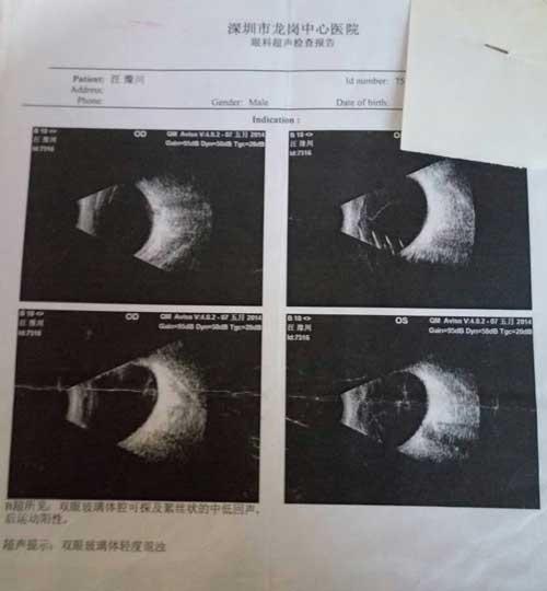 2013�꣬����Ϊ����ҩ��ļ������õ��°����ϣ���ɳ�������繤�������ӵ���Դ�������˰���������  ����ʱֻ�������ۣ��������ҵ����ۿ����������е�ģ�������ۼ��������������ˡ�