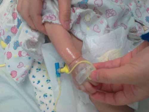 ��ƽ���������ְ����϶�����˯�����޿����������ٷ������⡣�ɽ���4�£������ڴ��ź����ڵ���ҽԺ�������飬ȴ����ϳ����ס���󣬷��������ź���������������ҽ����ϣ�&ldquo;Сƽ��&rdquo;����&ldquo;��֢֧���ܷ���&rdquo;��&ldquo;���ͺ���˥��&rdquo;��&ldquo;������&rdquo;��&ldquo;΢�����񾭼��ⲡ&rdquo;�ȣ����������ת����֢�໤�����ơ�