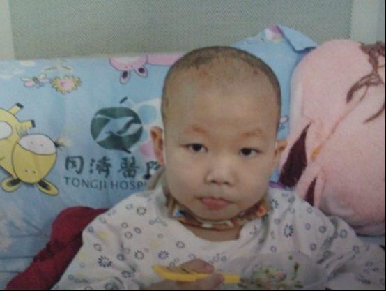 �����죬�����Ѿ���ҽԺ����ϵͳ����2�����£��������ι��贩�̣�6���������̣�ÿ�δ��̺�Ҫƽ��6��Сʱ���Ժ���������Ҫ�ְ�������������ڻ���ҩ���ǿ�̼���������Ż�¡���ʳ�����꣬Ϊ��ά�����������Ӫ�������ò���������ļ���ҩ��ͷ��Ҳ�������䡣