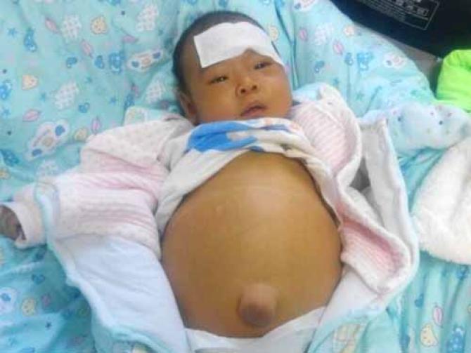 �����������������һֱû�лָ��������Ծɲ��˷�������103һֱ����Ŀǰ��283��������Ҳ���ϸ��������ӵĶ�����ˮ�ǵúܴ��ˣ�������Ϊ���岻�ʣ�������ֲ�ֹ����ĸ�����������Ϻ��ʼ�ҽԺ�����飬���ӵĸ���ά���Ѿ��ﵽ��36%��ҽ��˵����������ֲ���������������