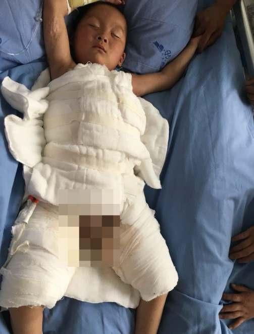 ����5�����ȣ����������ˣ������������������̫���Դ��ڸ�Ⱦ�ڡ�����ҽ�����߼ͺ갲˵��&ldquo;���ڸ�Ⱦ�ڵĺ��ӣ�������ʱ���ܱ�ϸ���Ͳ������֣�������������Σ�ա�&rdquo;ҽ�������»�ҩʱ�������ۡ���ʹ�࣬������һ��Ҳû�п��֡�����������ô���£����������ۣ��ͺ갲Ĩ������˵��