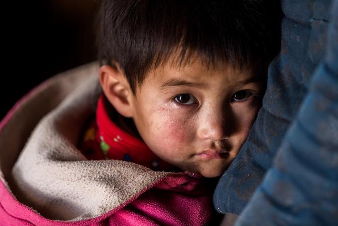 ���ڼ໤���Ļ�ˮƽ�͡�������ʶ��Į����ס�������ԭ�����ض�ͯ���ڽ϶಻����ϰ�� , ���ֲ���ࡢ�ϳ�ʱ�䲻ϴ�衢�߲̾������ȣ�Ӥ��ض�Ŵ��������۹� , ��������Ƥ���۹���Ⱦ��סԺ�Ĳ�����