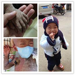 ����ǰ�Ͳ���Ա�ͼ������һ����ʱ���Ϳ����Ŀ����С�½�Ϊ���β������ܵĸ���ʹ�࣬��Һ����Ѫ����ҩ���ȼҳ��㷹��ÿ���������Ǵ�������ʱ�������ﴫ������˺���ѷεĿ޺����������Լ����ź������ȴʲôҲ�����ˣ���ϣ������������Լ����ϣ�������Щ���������溢�����š�