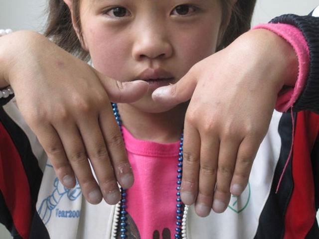 ���й����ܱ��ܵ�ͯ��ô�����й����ϵ��촽ô������û����Ϊȱ�������帡�ף�����û�й����ܴ�ں�����ʱ�����й�ĬĬ�ؿ��ű��С�����ˣ�����Լ�ֻ��������Ļ��￴����Ľ��ʱ��ô������Щ�����������ಡ�ı���ȫ������������