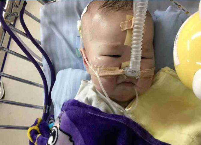 �������������ź��Ӹ������ݴ�ѧ������ͯҽԺ���ȣ�С�����ʱ������34��ҽ��˵�������͹���������û�������ˣ������ݶ�ͯҽԺ��֢����ICU�����������죬��������ƽ�ȱ�ת�͵������ƣ�С�����ȷ��Ϊ��֢���ף������������������������Σ�ͬʱ�����Ĺ��ܲ�ȫ��