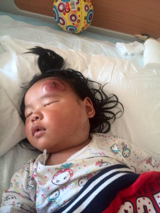 �����󸴷�