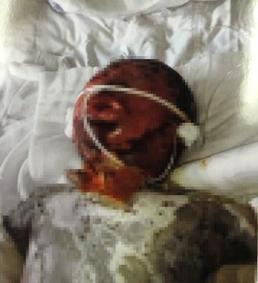 �����������صľ�����־˧���������ο�����˵��־˧�����ҩ��������˲�ȴﵽ��55%������������̽���β���θ���������ѣ��Ѻ��������п��ˡ�˧˧�Ѿ��������Ĵ�ֲƤ���������ƻ�����40����Ԫ��