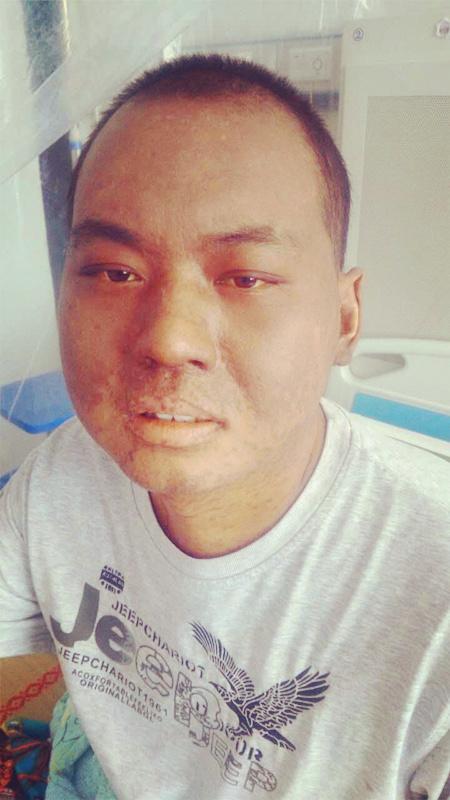 2016��6��18�գ�������ʡ����ҽԺ�������ƣ�7��2�ճ������죬18�ճ����������죬���ղ��ˡ���ҹŻ�¡�������ˮ���Ѿ�����ħ��ĥ�Ĳ������ӡ�