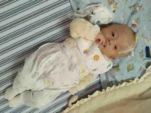 ����÷��Ϊ���������ˣ��ؼҰѺ��Ӵ��þͿ��Ի�ҽԺ�������ˣ�3��28�ջ�ҽԺ�����ڸ�������������С����һֱ���֣�һֱ״̬���ã������ҽ����鷢��С���ϻ����󲢷�֢��ճ�����������Ͻ����˵ڶ���������ճ���ĳ����ֿ����̶̵�����ʱ�䣬���������´��С���Ͼ��������ο����Ĵ�������