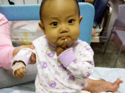 ҽ��������תԺ����֣�ݴ�ѧ��һ����ҽԺ�����ڿƱ�����������ʮ���죬��δ��ȷ�ֱ��ת����ƣ�������ǻ��̽�飬ҽ��ȷ����ͮ��������������Ҫ������ֲ������