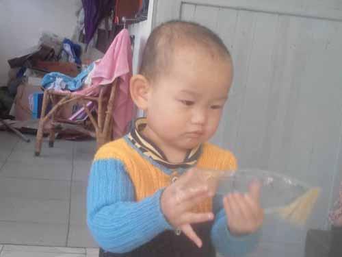 40��󸴲飬����С����Ѩ�ظ�λ�����ڸ��ű����������ص�һ�֣�ҽ������ڶ�������ǰ���������������������ڶ�������һ������֮��İ������ң�����š��޲�ֱ�����������������ѵ�һ������Ϊһ�㼴ʹ�Ǹ��ű����ĺ���Ҳ���ڸ��Ų�λ����һ��&lsquo;ӡ��&rsquo;