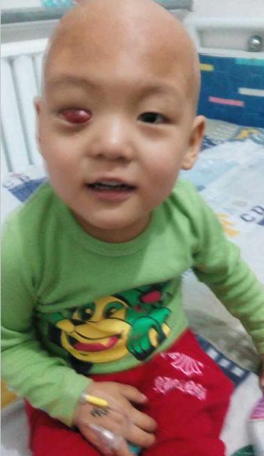 һ���˱����ⲡʹ�ᵽ�˽�����û�뵽��ʹ����ĥȴԶԶû�н������ڲ����������������²��鸴�����ڲ����鸴���ڼ������Ѿ������ۿ����м������ˣ�ҽ��Ҳ���鵽����ҽԺ���ܽ�һ�������ƣ��������������ļ���ٵĴ��Ų��鸴�����ڲ���������������ơ�