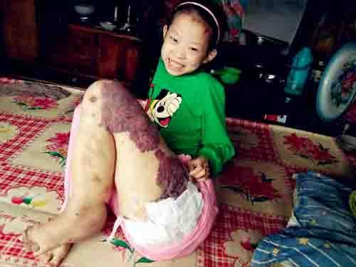 ���Ļ۳�����ɽ��ʡ�����ش�Ӫ����վ��,����ʱ������һƬ̥��,һ��ʱ��ĸ�����Ļ��Ȳ���̥��Խ��Խ��,��������̫ԭ���������ҽԺ������ϣ������ȷ��Ϊ����Ѫ�ܻ���Ѫ������