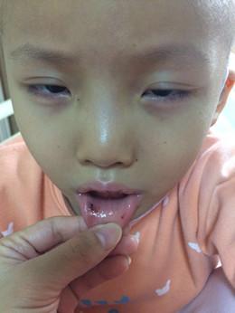 һ��������ԣ��������ơ����Ļ������ַ��������飬����ϣ�����ڴ������ܹ����⣬������С��������Ż�¡����ơ�ͷ���˱��ʮ�����������Ͽ�ʼ�����ߺͳ�Ѫ�㣬Ҫ����Ѫ��ѪС��ά�֡������Ƶ�ʱ��С����ͻ�¶�����õ�Ц�ݣ�����ħ�����Ͳ����ڣ�