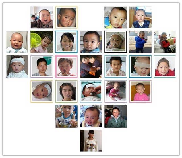 ���������ಡ������������ȱ��֮�ף��ǻ��������ĵ�һԭ�򣬷�����6&permil;��14&permil;�������꣬���Ĳ������������������ƣ�����ÿ��15-20�����Ĳ�������������30-40��֮�࣬�ҹ��������Ĳ�����Լ200�����ŷſ���̥���ߣ����䡢��Σ�и�Ҳ��������ӣ����Ĳ������������ؽ���һ�����ӡ�