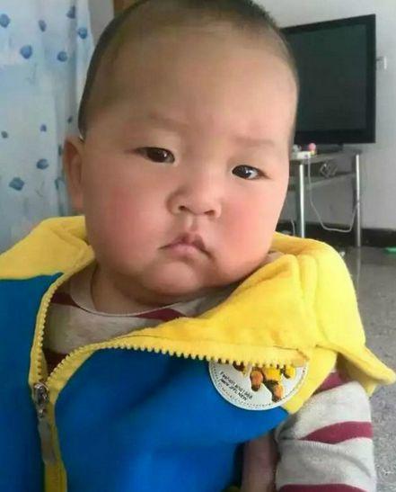 �ƺ���2016��2��24���������������֫��������Ƥ��ֲ����2016��3��1���������������֫��������ֲƤ��������˳�������ں�����ҽԺ���������迹��Ⱦ��ά��ˮ�����ƽ�⣬��֢֧�����ơ��ƺƲ���Σ�أ��Ժ�����ж��������