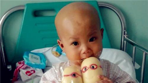 �ڻ�������֮�����ȵĲ����������ƣ����ι��ܽ�һ�����ˡ�С���ȵĸ������ر�󣬶������͵����Ƥ����������ü��ѡ�תԺ���׶�������������ͯҽԺ��ҽ��˵����Ŀǰ��״���н�һ����չΪ����˥�ߵĿ��ܣ�������и�����ֲ����Ԥ�Ʒ���Ϊ50��Ԫ��