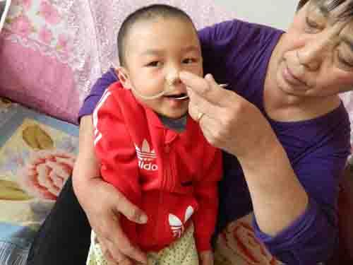 ������˿޲�֪������ô�죬ǰ���컹��������ı�����Ȼ���Բ��ѣ���ô�ж�û��Ӧ��ҽ��˵�������ø������˺�������������ȫ����飬˵�ǲ��������ף�����Ƶ���鴤�����˺ö��ֿ����ҩ�ﶼ���Ʋ�ס��Ҳ�����㻤���Ӵ˰ְ������������̽�Ӷ���һ�Σ�ÿ�βŲ���10����ʱ�䡣