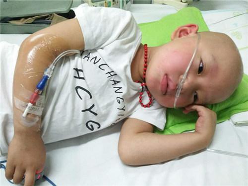 ����С�ܸܵճ���3�죬����4��Ŀ��Ĺ��Ͳ����ˡ���Ϊ�Ȳ�����ٳٲ��ˣ��ְִ����׵�����飬�����ڱ�����ͯҽԺ�����Ϊ�����ܰ�ϸ����Ѫ�����Ҹ���С��ͥ����������һ�������׽���ס��ҽԺ��ʼ���ơ�ÿ�컯�ơ�ʹ�ü��أ������ַ����ա���ݡ���ֻ�ܽ��и��롣