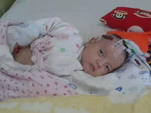 7��25�����ϣ�˼�����е�һ������������������ҽ�������˼�����У�1.�����Ծ޽᳦���ţ�2.�̳��ۺ��������г����ۺ�֢��3.��������ң�4.��л�����ж���5.���ɫ��ŧ���������������ŧ��֢��6.���������㣬7.������ȱ��ȱѪ��8.�����׵Ⱦ���֢״����Ҫ��һ���۲����ơ�