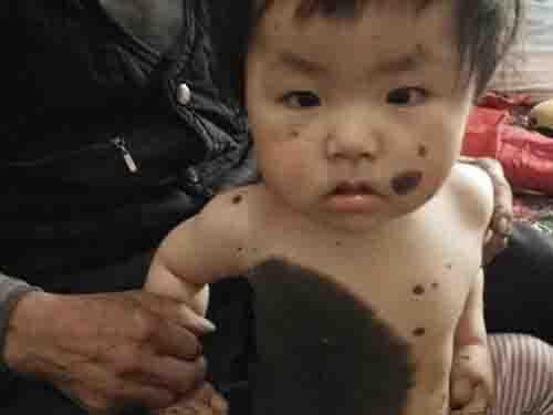 ����&ldquo;������Ƥ��&rdquo;��Ӱ�죬С˼���������������������ð���ա��������Ų��ϳ��������ϸ�������Ƥ��Ҳ�ߵ������󣬰ߵ���ɫҲ�м�������ƣ������Ǳ�����ǰ�ز��Ĵ�����߿��𽥱�񣬳���ʱ�߿���ԭ�еĺ�ɫ��ëҲ���������ɺ�ɫë����ë���ĳ���Ŀǰ�Ѿ������˶��������׳��ȡ�