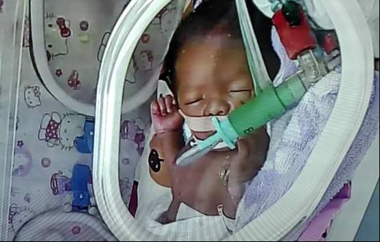 2��18�գ���Ϊ�󱦸�Ⱦ�Ѿ�����������ҽ��������Ŵ󱦳�Ժ������Ҳ�����ܹ������Ŀ����󱦣���������СС�ĺ�����������Ļ�������Ķ�Ҫ�ڻ��ˡ�����ָ��������۵�ɸ�飬�����۾��в��䣬������3��31������ס����ҽԺ��סԺ�����ִ�������ȷ��ף����������Ͳ���