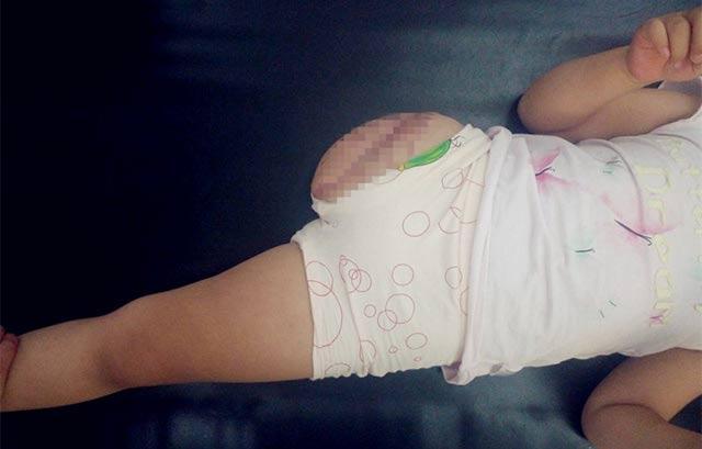 ֮�����˼����Ľ�֫������ס����������תԺ��ʯ��ׯ���ںӱ�ҽ�ƴ�ѧ��������ҽԺ����7��������סԺ����100��������տ�����Ժ������ֻ��4���������˵���������ܹ��������ᵽ�����ϵļ�����ʹ֮�⣬��������ʶ����δ��������Ҫ���ٵ��ޱȵļ����;޴����ս��