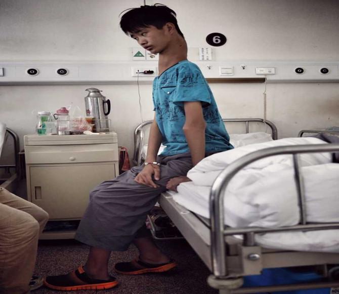 ������������Ի��⣬��׵������ȴ�����ˡ�С��ľ�׵�볣�˲�ͬ��������ֻ���߽ھ�׵�ǣ���С��ȴ��10�ڣ����ڲ�ͬ�ĳ����ӣ�������С�����ò��Щ���죬����Ϊ��׵���ζ���ѹ���񾭵�����֫��ʼ�������ط�Ӧ��2014�꣬С��˫�ȳ�����������Ӧ���ڴ�Ե�İ��������˾�׵������֢״�ŵ��Ի��⡣