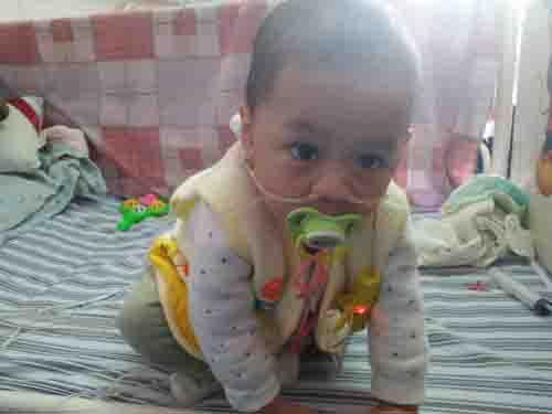 �ݵ�Ƥ���ǵ�С������һ�λؼң��ؼҺ󾭹���ĸ���ĵ��չ������������ˡ�������Ϊ��ʳ������©ʱ�����ף���15��3��5�ո�ĸ�ֶ�ƴ���ճ���11���Ǯ���׶���ͯ�о���������ͯҽԺ���˵����ο��ز�©��������������һס��������������һֱû�кã���5��12������ǻ������ת�����ϲ���ͯҽԺ��