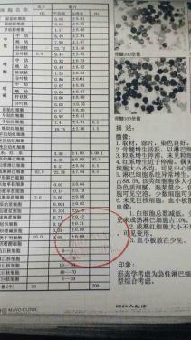 �޿�ƺ��ѪҺ���鵥