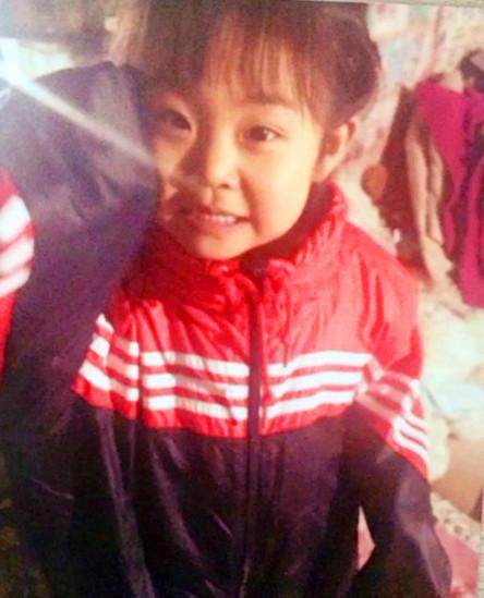 ����2014��4�£����ø��ղ��ˡ���ɫ���ƣ����ϰ��г�Ѫ�㣬��������͵��������Ľ��ݸ���ҽԺ�������ҽ������ǰ�Ѫ�������ǲ���������������ĸ����������ҹȥ������ѧ����ҽԺ�����ñ�ȷ��Ϊ�����ϰ���ƶѪ����ĸ�����������ѪҺ�о��������������ҽ��������������ֲ