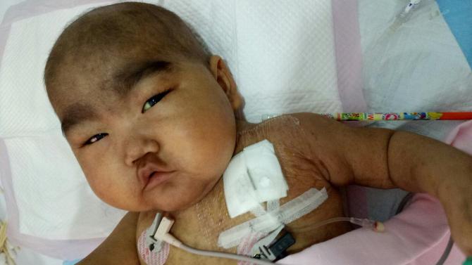 ��ƴ����7���Ǯ��ת���˱�����ͯҽԺ�����˼��������Ǵ���ÿ�첻ͣ��Һ��Ѫ��Ѫ��û��һ���õĵأ�ȫ�����ۣ�С�����ƺ��������������ھ������������۶�ֻ��С���ؿޣ��Ӳ��Ҷ����Һ޲����Լ����������ܿ࣬�������ﻹ��ֻ����ֲһ��·�ߣ����龡����ֲ��