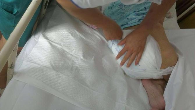 �ں�ͯ95%�����˴���ʧ��״̬���������˵�ʧ������Ҳһֱ�ǻ���Ա��ÿ�ջ������˵�һ����Ҫ���ݡ��ܶ�����Ժ������ô�ͳ���򲼣����򲼲�����������Ƥ��������������ζ��������ҪƵ����ϴ����������ʱ��������Ƥ�����׻��촯�����⡣