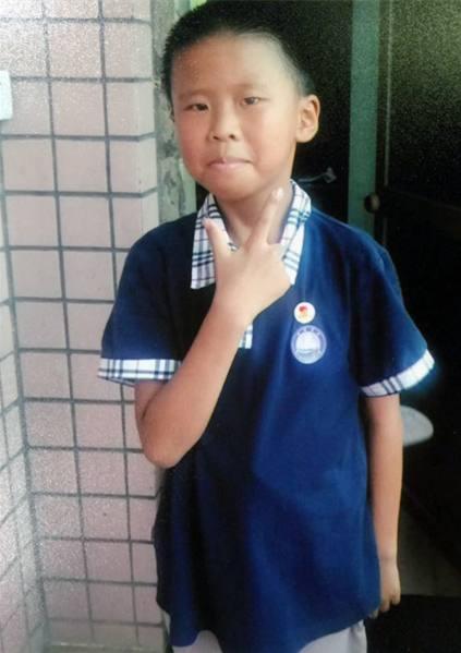 ��������ദ�����������5��17�˴�������ȥ��֣�ݴ�ѧ������һҽԺ������ƣ����ٴ�ȷ��Ϊ��֢������Ҫ������ֲ�����ſ��ָܻ����ӵļ࿴����ֲ�������������Ҫ�����������ϵ����٣���Ҫ���ʵ���Դ����Ҫ��ʵ����Ʒ��á��������һ�У�һ�ҿ��ſ���Ȭ���ĺ����ָ����ַ��