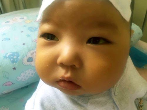 ���Ǻ����Ļ��㲢û����Ȼ��ȥ����ĸ������ȥ�˵�������Ժ��ȥ������ҽԺ��ҽ����˵û��ϵ��ɹɹ̫���������ٻƻؼҳԣ�ֱ���������γ��и��ױ���Ժ�������ҽ�����ú���������ֹۣ��ú������Ͼ��Ĵ�ҽԺȥ���������Ͼ�ͨ���˴Ź����飬ȷ�ﺢ�ӻ�����������ֻ�и����������Ի��⺢�ӵ�֢״��