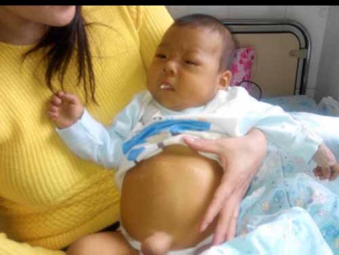 ������ĸ�ĸ���������������ͣ�����Լ������һ���ָ����ӣ����������������ǲ����ٴ���Ϯ������飬ҽ����Ϊ������ĸ������״�������������׹����Ҫ��������Ⱥ��ӵķ�������ʱ��׹���ߣ���ӵ���ۣ����εز�֪����Ǻã��ɼ�����ˣ������Ծɲ�������ɰ���������