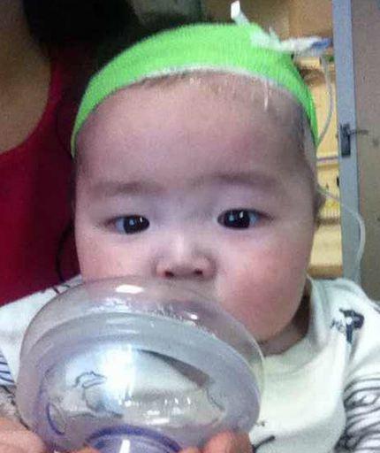 �������ֱ��ź��ӻص����ݶ�ͯҽԺ��������ֲ�����軼��������ף��������ѣ�������ʮ�����β���΢��ת���������ƺ�ѪС����Ȼ�᲻��ȥ��ҽ���ô�ҩ�ؼҹ۲顣ֻ�лؼ�һ���ں���סԺ���ơ�����ÿ��סԺ���Ѷ���1-2��Ԫ���ң��ڼ��Ϻ��ӵ��̷ۣ����������ң��������еĻ�����������Ϳ��ˡ�