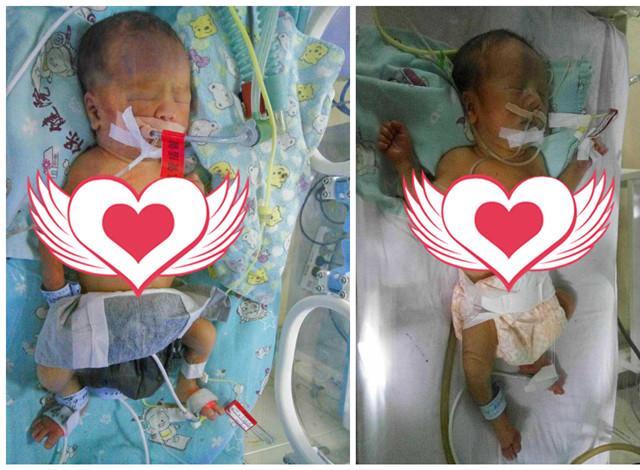 ����Ŀǰ�������Ӷ������ź���������С������Ϊ����ܵ�ϸ����������Ⱦ��ͬʱ���������ذ�Ѫ֢�ȡ����ڷβ�������δ��ȫ��С������ʱ������ֹͣ��10��10����������ݿ�֢״�����ڼ�ʱ���Ȳŵ������ѡ������Ȼ��С����Щ����Ҳ��Ҫ�������������Ʋ�һֱ��ҩ����������ֹۡ�