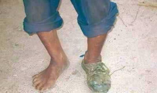 ����ʰ����������Ь��ʱֻ��һֻ����֪ʲôʱ���ܼ���һֻ����������Ь�ĺ��䡣