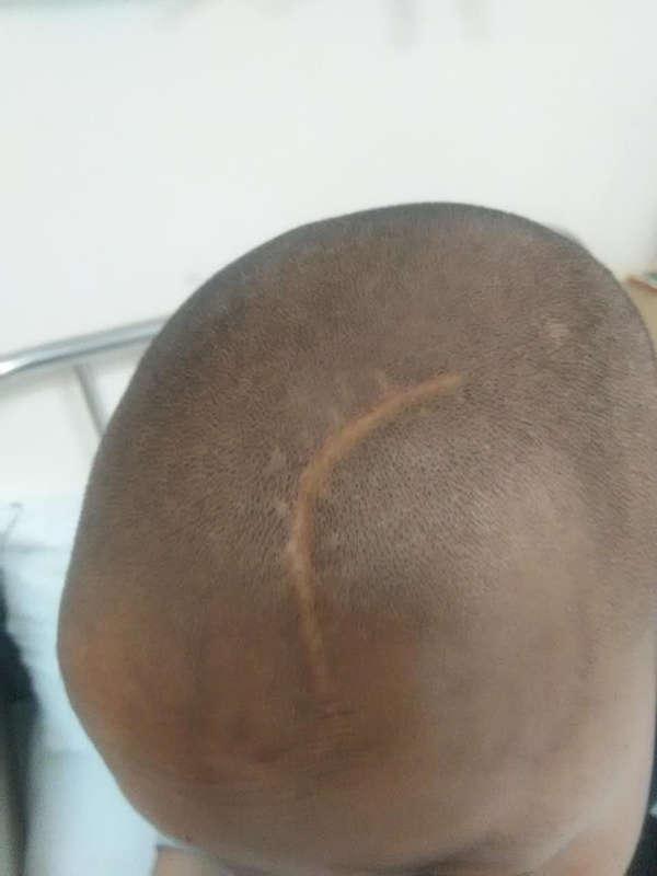 ����ɣë9����ʱһ������Ħ�г���������㶪����������ҽԺסԺһ�ܶ࣬ͷ�������13�룬����������ۣ���ʱû���ҵ������ߣ�סԺ�ڼ�ķ��ö���ĸ�׵��������ģ�Ϊ��Ƿ���˲�֪��ʱ�ܻ���ծ����������������������Խ��Խ���أ��������ʱ�����п���Σ�������׵�������