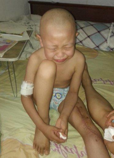 2015��9��10�գ��ְַ����������ϥ������һ���׿飬�ڶ���ʹ����ȥ�������ж�ͯҽԺ����飬����ҽ������������λ���������������������֯�����뵽���衣ҽ��������������ڵ���������Ҫ����֫��������������ȥ����ҽԺ����֫����������ͨ���ؽ��û��������ӵ����ȡ�