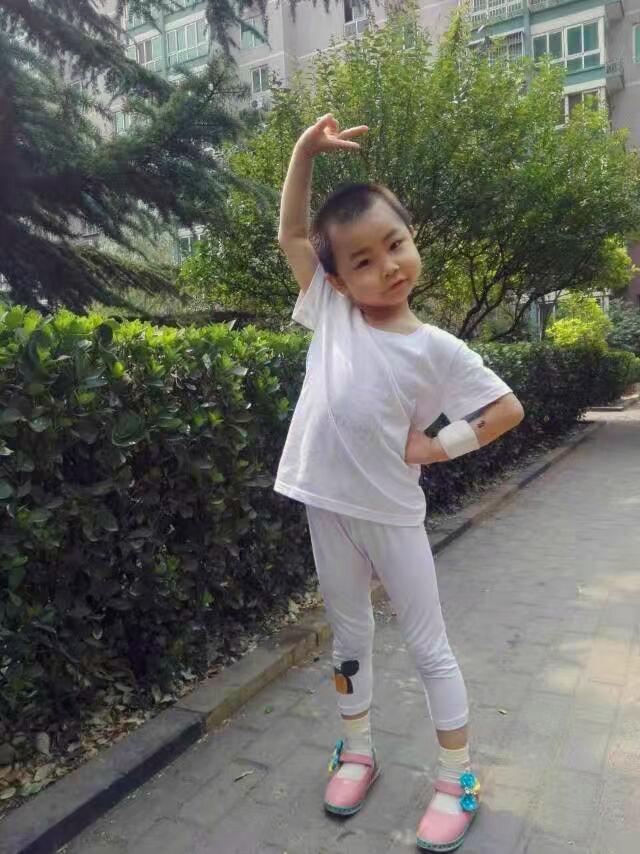 ��ȻŮ����˲��ң��������ǻ���ϣ����˼����һ���Ƴ̾���ȫ�����ˣ��ںϻ���Ҳת���ˣ�����Ҳ������18���£�ҽ��˵˼���������ɹ�����80%���ϣ�����������������꣬����Ϊ��������������һ�����