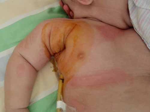 2015��8��19�գ�������ס���½�ҽ�ƴ�ѧ������һҽԺ��6�������Ҹ���ܰ���ɨ��������һ�ܣ�ҽԺ���߲������棺�����������Ұ��ܰ�ת�ơ�Ϊ����������������ִ��ź��ӵĲ�����Ƭȥ�½�����ҽԺ�ٴ���ȷ���������½�����ҽԺ������ר����Ϊ�����ӵĲ������Ƕ��������������Ƕ��Ի�̥����