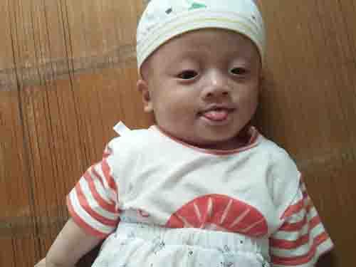 ����Ϣ��������ϲ�еļ�������һ����ˮ��Ҳ�����˺��¡���ҹת���ϲ���ͯҽԺ֮�󣬾�Ժ���ټ�Ȩ��ҽ����Ա���ȷ��Ϊ�����Գ�������֢������С�����㣬ҽ��˵����Ҫ����������������С�����ڳ����ĵڶ���Ϳ��������������������С���Ͼ���ʮ��������ƣ���12��29�ճ�Ժ�ؼҵ����ıȽ�˳���� 