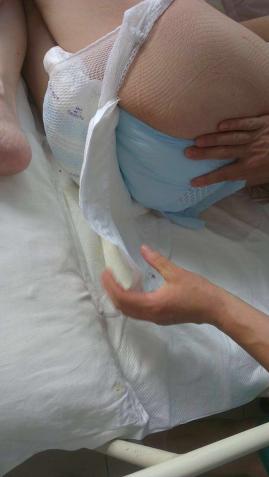 ��ͳ�ƣ�60������������������ʧ���ķ����ʴ�Լ18.9%��Ů����������ʧ���ķ����ʴ�Լ37.7%,��סԺ�����겡�˸ߴ�47%��ͬʱʧ���ķ������������������������������������ʧ������Զ��������Ϊ��Ҫ���ø�Ϊ�ձ顣