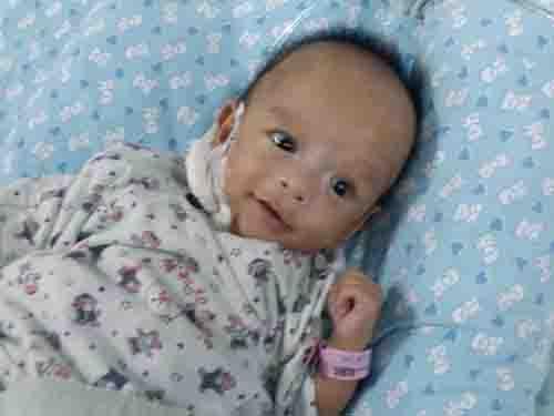 2015��5��23�գ��ڹ㶫ʡ��Զ������ҽԺ����һ��˫��̥����罨������3.08������ܵܽ���ֻ��1.8�����Ϊ��������ƫ�ͣ�Ҫ������ס�������Ʊ�����������塣