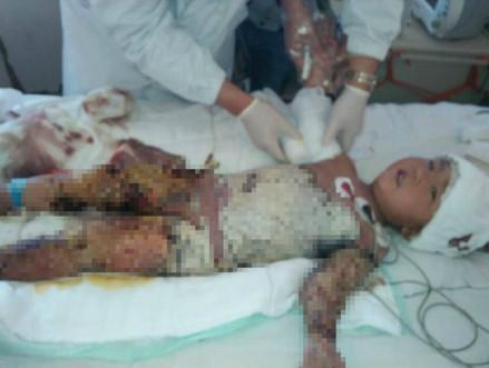 ��Ϊ��������ϴ��Һ����أ���Ҫ���ж��������ҩ�︨�����ƣ��߰������Ʒ����úƺƱ����Ͳ���ԣ�ļ�ͥ�ߵ��������ͱ����ı�Ե��ÿ��ƺƵİְ֡�������ҽԺ���չ˺ƺƣ���Ϊ���ӵ�ҽ�ƷѶ�ͷ�ۡ�